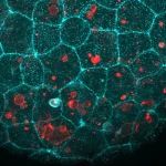 Biological "Glue" Found to Play Unexpected Role in Cellular Cleanup
