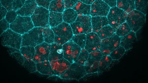 Biological "Glue" Found to Play Unexpected Role in Cellular Cleanup