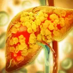 Researchers Identify Key Enzyme That Could Prevent Severe Liver Disease Progression