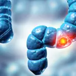 Rising Rates of Advanced Colorectal Cancer in Young Patients Spark Urgent Call for Earlier Detection